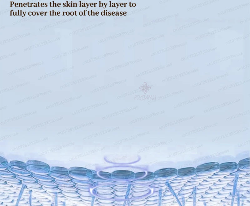 Skin Tag Removal