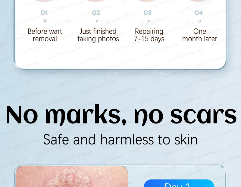 Skin Tag Removal