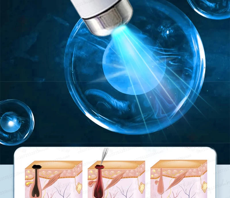 Skin Tag Removal