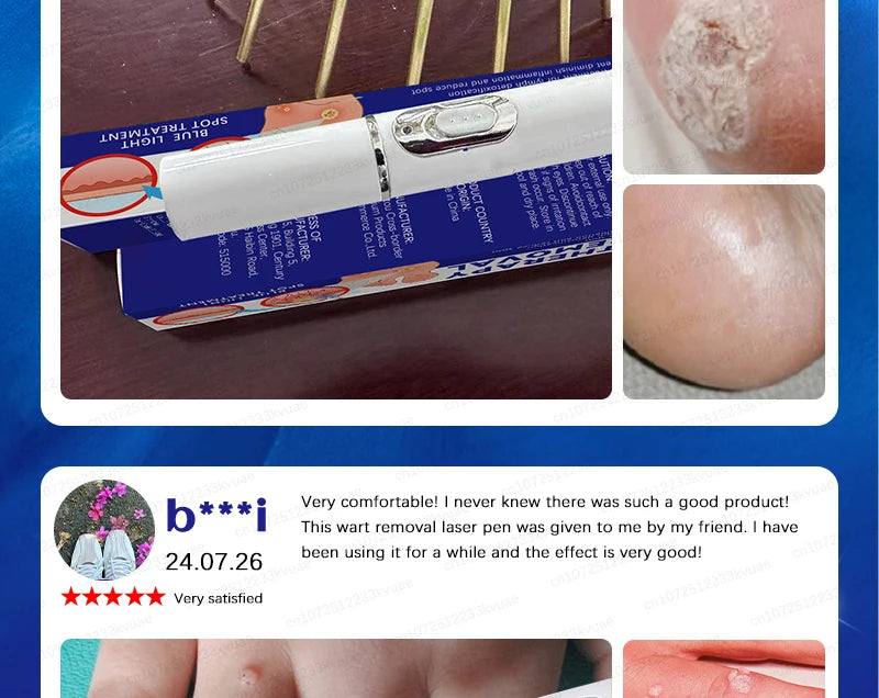 Skin Tag Removal