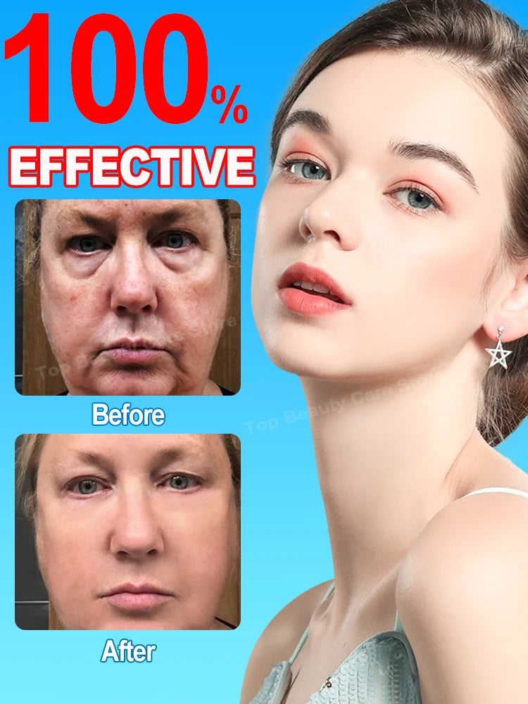 Anti-wrinkle Essence