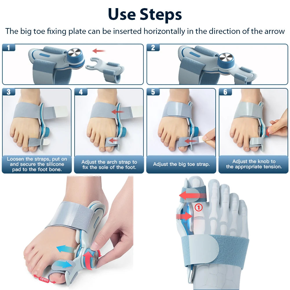 3 Angle Bunion Straightener