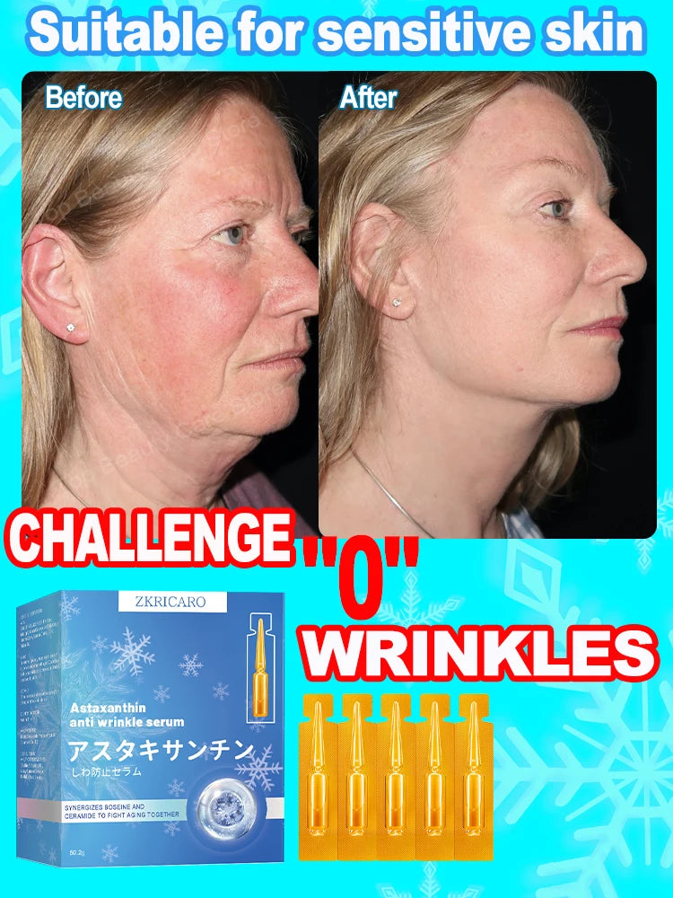 Anti-wrinkle Essence