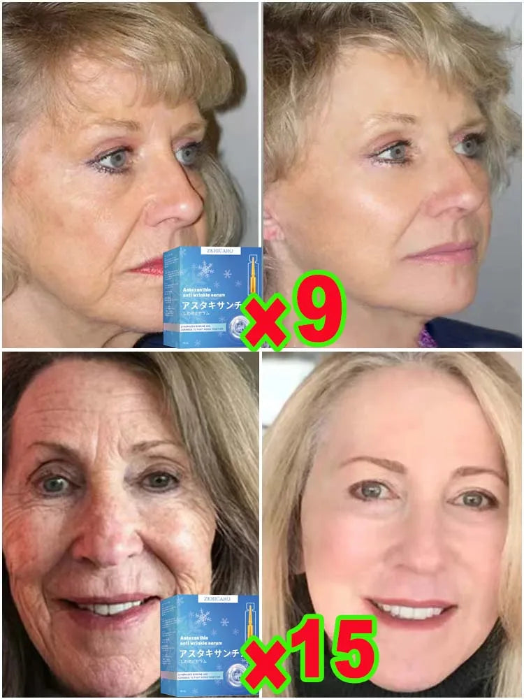 Anti-wrinkle Essence