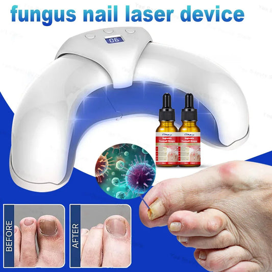 Fungal Nail Laser Device Repair